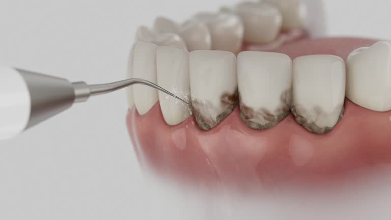 Trusted Dental Crowns And Bridges service in Woodlake, CA - Dentist Open Now